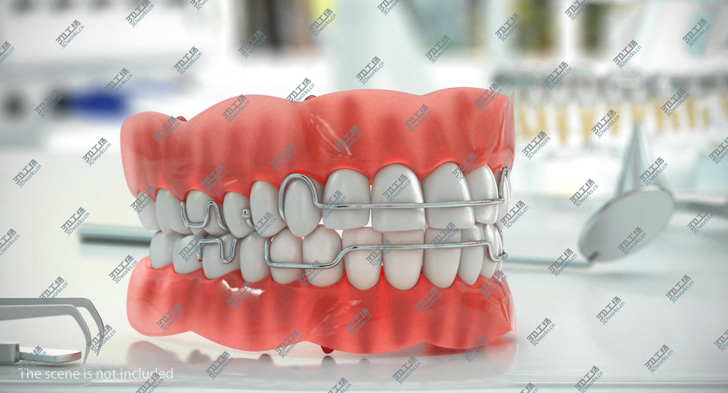 images/goods_img/2021040165/Typodont Tooth Orthodontic Retainer model/5.jpg